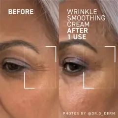 Dr. Brandt Needles No More Wrinkle Smoothing Cream - Smooths Expression Lines, Firms & Protects the Skin