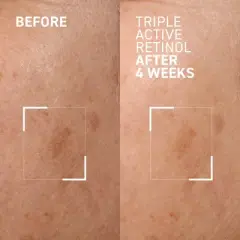 Dr. Brandt Bright This Way Triple Active Retinol - Gentle Overnight Renewal Cream - Reduces Wrinkles & Discoloration, Illuminates & Hydrates