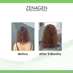 Zenagen Evolve Nourishing Shampoo (6.75 oz) and Evolve Nourishing Conditioner (6.75 oz) | Repairs Damage Hair | Brittle Hair - DUO SET Kit