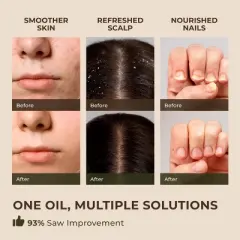 Gya Labs Australian Tea Tree Essential Oil for Skin - 0.34 Fl Oz - Melaleuca Tea Tree Oil for Hair