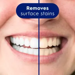 Crest 3DWhite Advanced 2.5% Hydrogen Peroxide  - 3.0oz