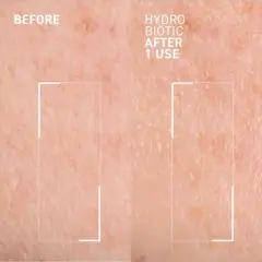 Dr. Brandt Hydro Biotic - Recovery Sleeping Mask - Deeply Hydrates + Reduces Redness & Signs of Irritation