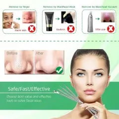 5PCS Blackhead Remover Set &ndash; Curved Tweezers & Comedone Extractor Tools Kit for Acne & Pimple Removal