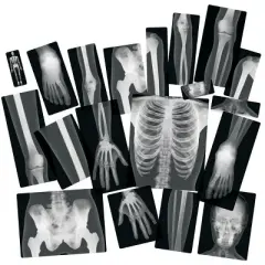 Royclo Human X-Rays on Film - 18 Pieces