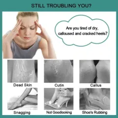 Foot File Callus Remover - Multi Purpose 4 in 1 Feet Pedicure Tools with Foot Scrubber,Pedicure Tool with Foot Scrubber, Pumice Stone