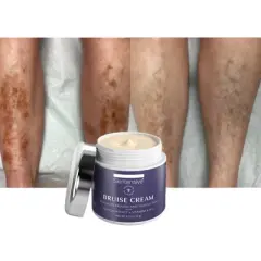 SKINTENSIVE Arnica Bruise Cream, 4 Oz, for Thin Skin, Moisturizing, Vitamin K C and E, Skin Renewal