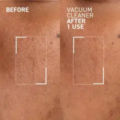 Dr. Brandt Pores No More Vacuum Cleaner - Pore-Purifying Mask to Unclog & Shrink Pores