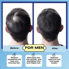 Mediceuticals Cellagen Follicle Revitalizer | Excessive Hair Loss and Thinning Hair|Reduction of Excessive Hair Loss (8.45 oz)