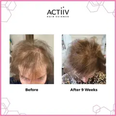 ACTiiV Hair Science Recover Shampoo & Conditioner for WOMEN Duo (16 oz XXL Pro Set) Active Thickening & Volumizing | Reduce Hair Loss | Fuller Hair