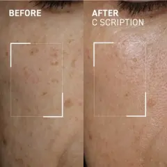 Dr. Brandt Bright This Way C Scription - Concentrated Vitamin C Serum