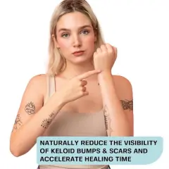 Base Laboratories Keloid Bump Removal Gel - Scar Treatment Gel | Keloid Scar Removal | Soothing Piercing Aftercare Gel - (2 oz)
