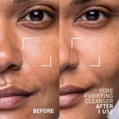 Dr. Brandt Pores No More, Pore Purifying Cleanser - Non-Drying Gel - Helps to Minimize the Appearance of Pores & Dissolves Impurities