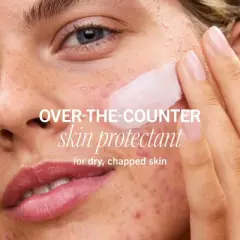 FIRST AID BEAUTY UR Rescue Balm, Moisturizing Face Cream for Dry. Sensitive and Damaged Skin - 2.25oz - Ulta Beauty