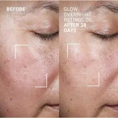 Dr. Brandt Bright This Way Glow Overnight Retinol Oil - Pure 2% Retinol Improves Wrinkles, Lines & Skin