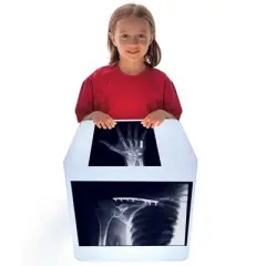 Roylco Fixed Bones X-Ray Set