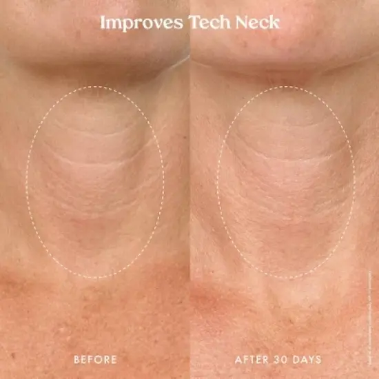 Kopari Ultra Renewal Retinol Body Cream - 4.7 fl oz - Ulta Beauty image {10}