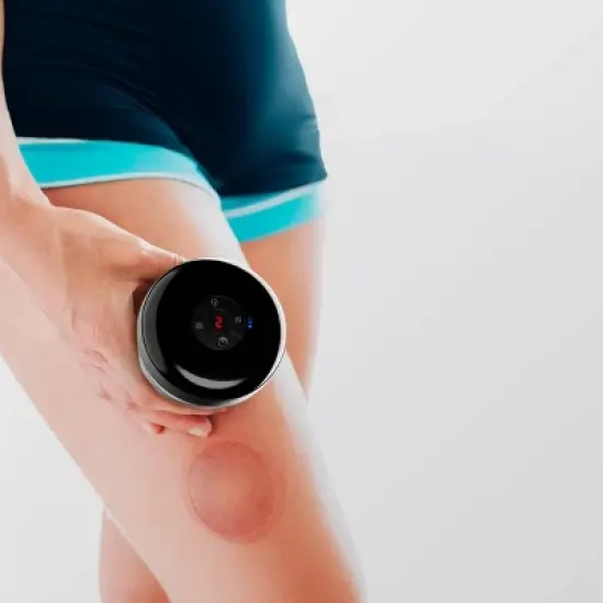 Sharper Image Pulse Cupping Multifunction Massager: Handheld Acupressure Device, Battery-Powered image {2}