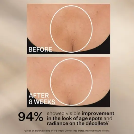 StriVectin Tightening Neck Cream - 1oz - Ulta Beauty image {7}