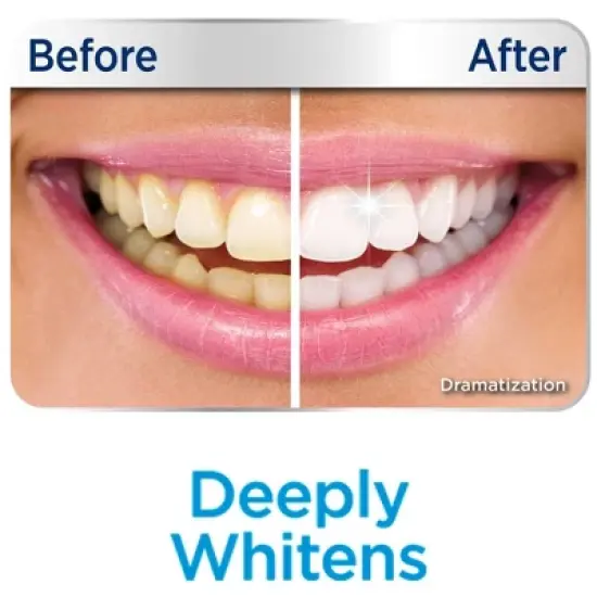 Miracle Smile Teeth Whitening Gel - 2 fl oz image {3}