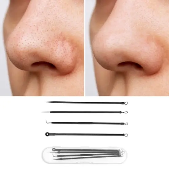 Unique Bargains Facial Pimple Extractor Tool Set 1 Set image {4}