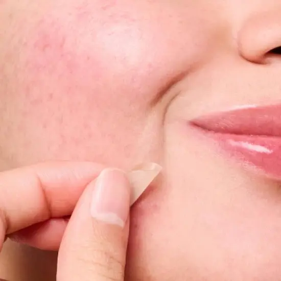 Hero Cosmetics Mighty Acne Pimple Patch Micropoint for Blemishes - 8ct image {6}