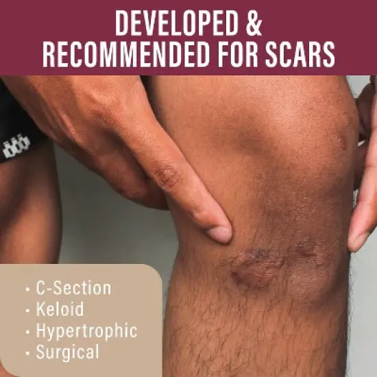Nuvadermis Scar Gel for Surgical Scars - 1oz image {2}