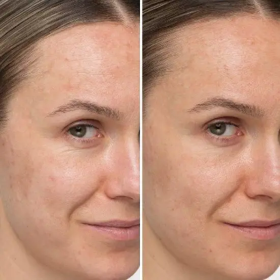 IT Cosmetics Confidence In A Cream Anti-Aging Face Moisturizer - Ulta Beauty image {2}