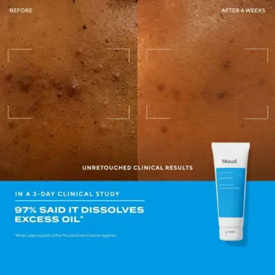 Murad Acne Clarifying Face Cleanser - Ulta Beauty image {3}