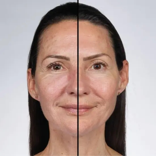 No7 Future Renew Damage Reversal Face Serum - 0.85 fl oz image {4}