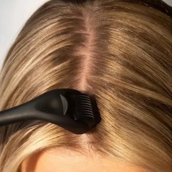 Beautimate Titanium Microneedle Derma Roller for Skin & Hair Care image {13}