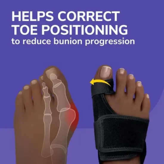 Dr. Scholl's Bunion Relief & Toe Corrector - 1 pair image {3}