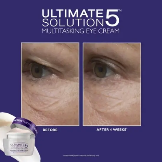 PETER THOMAS ROTH - Brightening & Beyond Travel Kit - 3pc - Ulta Beauty image {6}