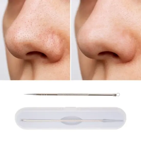 Unique Bargains Convenient Pimple Extractor 5.51''x1.15" 1 Pc image {4}