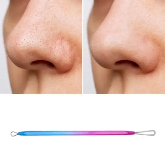 Unique Bargains Professional Gradient Pimple Extractor Blue Purple 1 Pc image {4}