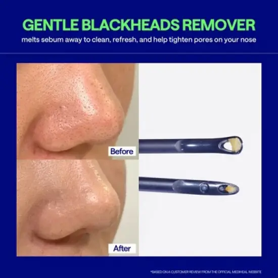 Mediheal Blackhead Melting Clear Nose Patch - 4 count image {4}