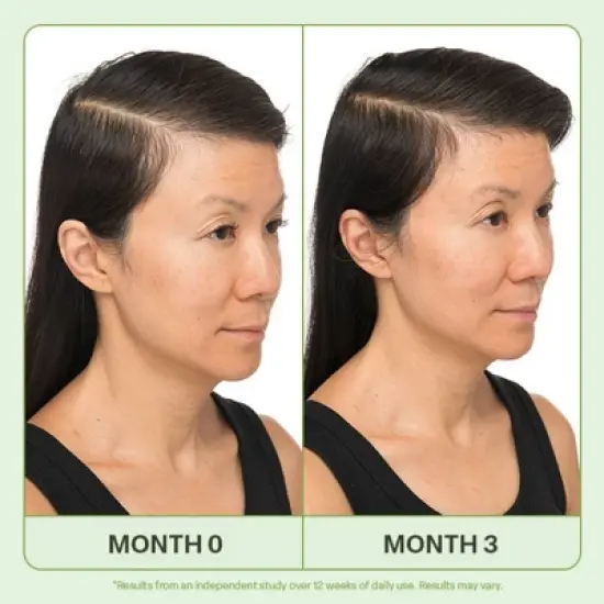 Divi Mini Scalp Serum - 0.5 fl oz - Ulta Beauty image {2}