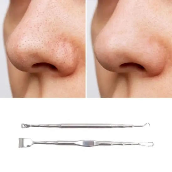 Unique Bargains Hook Tip Pimple Extractor 5.11" Silver Tone 1 Set image {4}