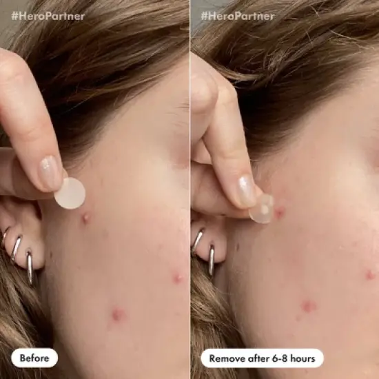 Hero Cosmetics Mighty Patch Day & Night - 36ct image {5}