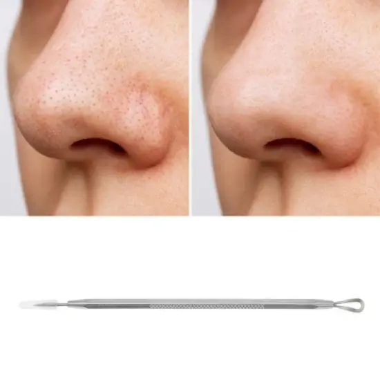 Unique Bargains Durable Acnes Pimple Extractor Silver Tone 1 Pc image {4}