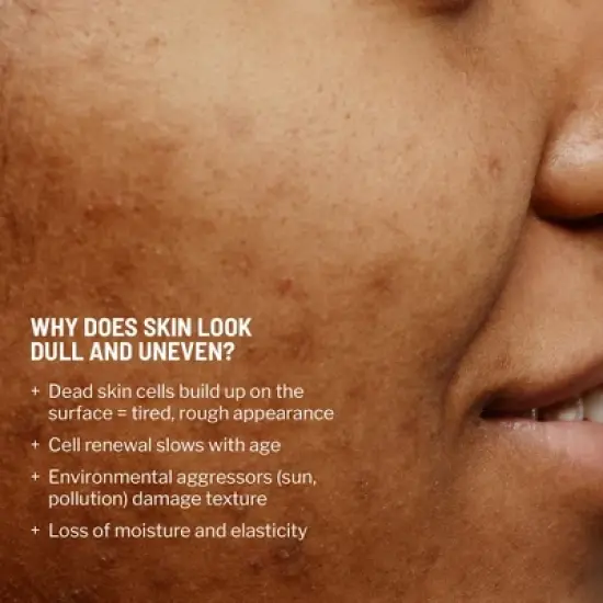 Dr. Brandt Advanced Microdermabrasion Face Exfoliator - Refines Texture, Minimizes the Look of Fine Lines & Enhances Overall Skin Tone image {3}