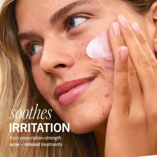 FIRST AID BEAUTY UR Rescue Balm, Moisturizing Face Cream for Dry. Sensitive and Damaged Skin - 2.25oz - Ulta Beauty image {3}