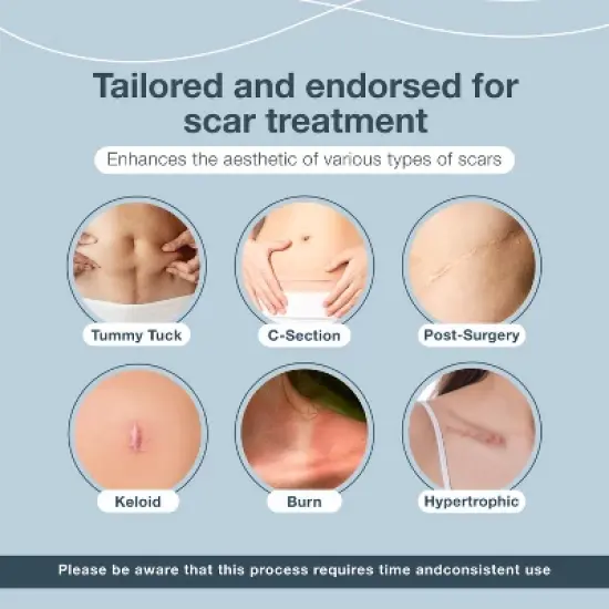 Silicone Scar Sheets, Scar Tape for Surgical Scars, 120" x 1.6" Roll - C-Section, Tummy Tuck, Keloid Scar Treatment, As Post Surgical Cream, Gel image {3}