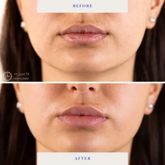 BioRepublic SkinCare Lip Masks - 3pk image {2}