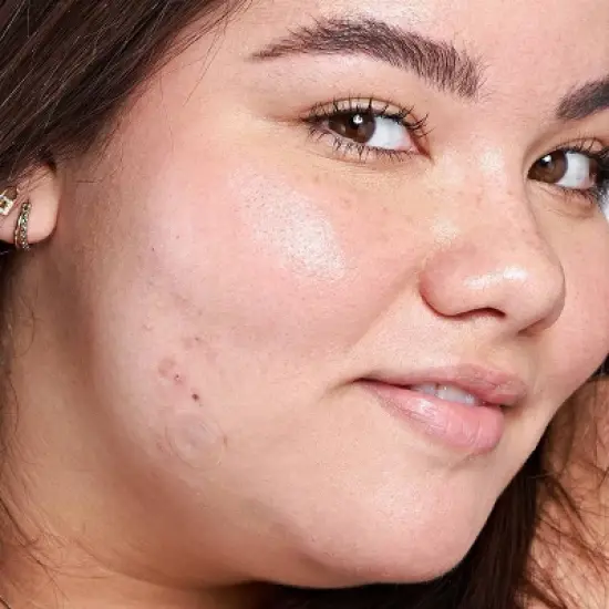 Hero Cosmetics Mighty Acne Patch Micropoint for Dark Spots - 8 patches image {9}