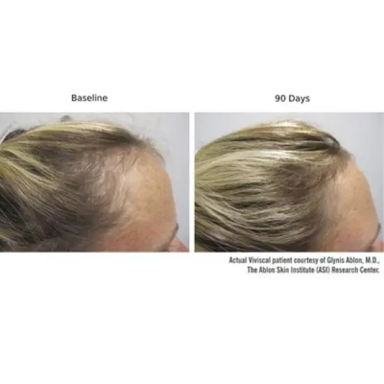 Viviscal PRO Advanced Hair Health PROFESSIONAL STRENGTH Dietary Supplements (180 tablets) AminoMar Marine Complex & Biotin image {5}