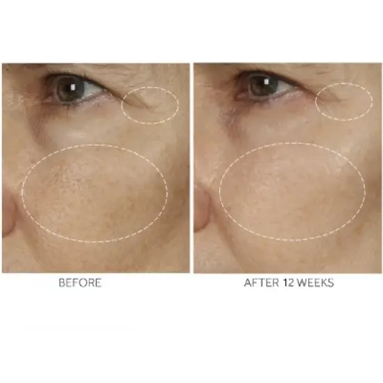 No7 Advanced Retinol 1.5% Complex Night Concentrate - 1 fl oz image {9}