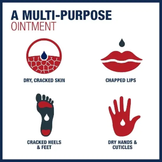 Aquaphor - Original Ointment, For Dry Skin Treatment, 14 Oz image {4}