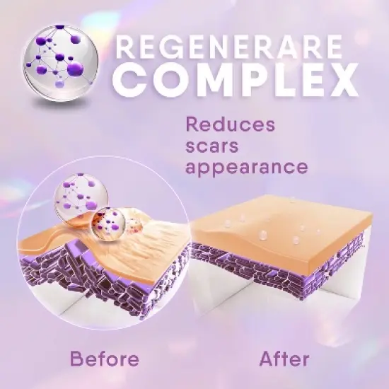 Cicatricure Scar Gel 1oz image {6}