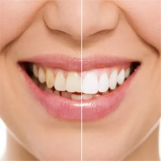 Rembrandt Intense Stain Whitening Toothpaste - Mint image {5}