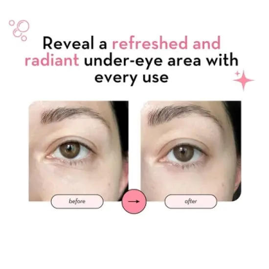 Elizabeth Mott 24K Gold Under Eye Patches with Collagen & Niacinamide - Hydrating & Brightening Eye Mask - 20 Pairs image {2}